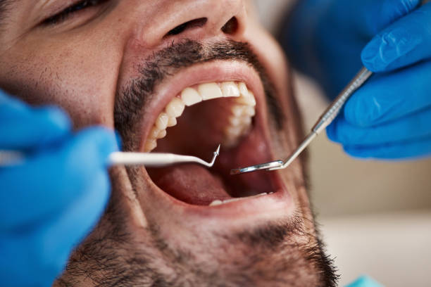 Best Emergency Dentist for Knocked-Out Tooth in Mccall, ID