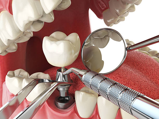 Best Emergency Dental Services for Seniors in Mccall, ID